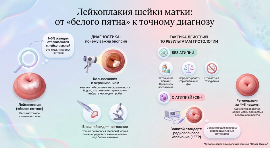 Лейкоплакия шейки матки